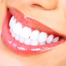 LDC Dental Associates Teeth Whitening